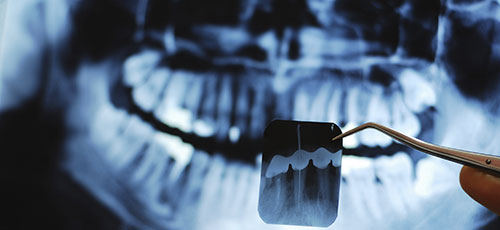 Xrays & Dental  Hygiene, Winnipeg Dentist